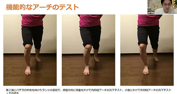 ③講義：立位での足関節・足部の評価